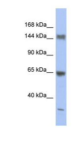 ATXN2 / SCA2 / Ataxin-2 Antibody - ATXN2 / Ataxin-2 antibody Western blot of PANC1 cell lysate. This image was taken for the unconjugated form of this product. Other forms have not been tested.