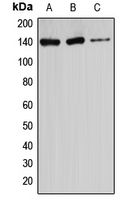 ATXN2 / SCA2 / Ataxin-2 Antibody - Western blot analysis of Ataxin 2 expression in HeLa (A); U87MG (B); Jurkat (C) whole cell lysates.