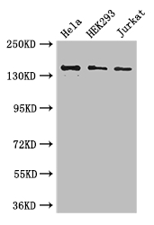 ATXN2 / SCA2 / Ataxin-2 Antibody - Positive WB detected in:Hela whole cell lysate,HEK293 whole cell lysate,Jurkat whole cell lysate;All lanes: ATXN2 antibody at 3ug/ml;Secondary;Goat polyclonal to rabbit IgG at 1/50000 dilution;Predicted band size: 141,107,28,133,110 kDa;Observed band size: 141 kDa;