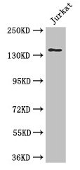 ATXN2 / SCA2 / Ataxin-2 Antibody - Western Blot Positive WB detected in: Jurkat whole cell lysate All lanes: ATXN2 antibody at 3µg/ml Secondary Goat polyclonal to rabbit IgG at 1/50000 dilution Predicted band size: 141, 107, 28, 133, 110 kDa Observed band size: 141 kDa