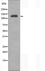 ATXN2 / SCA2 / Ataxin-2 Antibody - Western blot analysis of extracts of HepG2 cells using ATXN2 antibody.