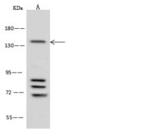 ATXN2 / SCA2 / Ataxin-2 Antibody - Anti-ATXN2 rabbit polyclonal antibody at 1:500 dilution. Lane A: HeLa Whole Cell Lysate. Lysates/proteins at 30 ug per lane. Secondary: Goat Anti-Rabbit IgG (H+L)/HRP at 1/10000 dilution. Developed using the ECL technique. Performed under reducing conditions. Predicted band size: 140 kDa. Observed band size: 140 kDa.