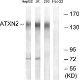 ATXN2 / SCA2 / Ataxin-2 Antibody - Western blot analysis of extracts from HepG2 cells, Jurkat cells and 293 cells, using ATXN2 antibody.