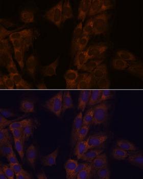 ATXN2 / SCA2 / Ataxin-2 Antibody - Immunofluorescence analysis of C6 cells using ATXN2 Polyclonal Antibody at dilution of 1:100.Blue: DAPI for nuclear staining.