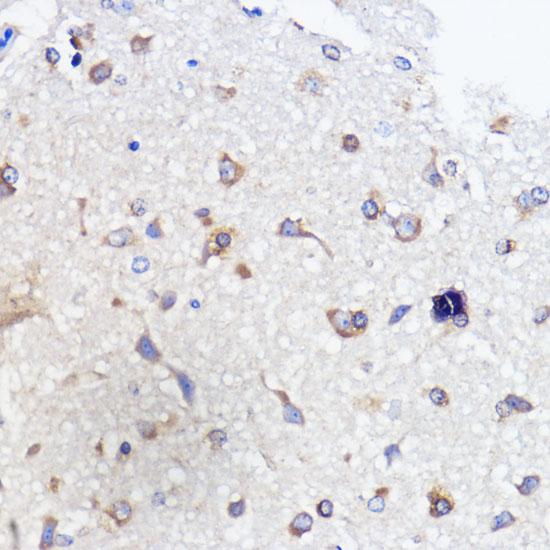 ATXN2 / SCA2 / Ataxin-2 Antibody - Immunohistochemistry of paraffin-embedded Rat brain using ATXN2 Polyclonal Antibody at dilution of 1:100 (40x lens).