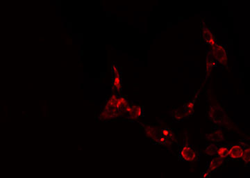 ATXN2L Antibody - Staining NIH-3T3 cells by IF/ICC. The samples were fixed with PFA and permeabilized in 0.1% Triton X-100, then blocked in 10% serum for 45 min at 25°C. The primary antibody was diluted at 1:200 and incubated with the sample for 1 hour at 37°C. An Alexa Fluor 594 conjugated goat anti-rabbit IgG (H+L) antibody, diluted at 1/600, was used as secondary antibody.