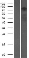 ATXN2L Protein - Western validation with an anti-DDK antibody * L: Control HEK293 lysate R: Over-expression lysate