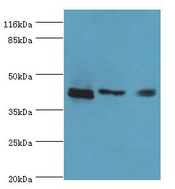 ATXN3 / JOS Antibody - Western blot. All lanes: ATXN3 antibody at 2 ug/ml. Lane 1: 293T whole cell lysate Lane 2: Mouse brain tissue Lane 3: MCF-7 whole cell lysate. Secondary antibody: goat polyclonal to rabbit at 1:10000 dilution. Predicted band size: 42 kDa. Observed band size: 42 kDa.  This image was taken for the unconjugated form of this product. Other forms have not been tested.