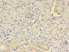 ATXN3 / JOS Antibody - Immunohistochemistry of paraffin-embedded human pancreas tissue using antibody at 1: 100 dilution.  This image was taken for the unconjugated form of this product. Other forms have not been tested.