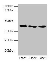 ATXN3 / JOS Antibody - Western blot All lanes: ATXN3 antibody at 2µg/ml Lane 1: 293T whole cell lysate Lane 2: Mouse brain tissue Lane 3: MCF-7 whole cell lysate Secondary Goat polyclonal to rabbit IgG at 1/10000 dilution Predicted band size: 42, 36, 40, 21 kDa Observed band size: 42 kDa
