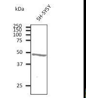 ATXN3 / JOS Antibody - Anti-ATXN3 antibody at 1:500 dilution. Lysates at 100 ug per lane. Rabbit polyclonal to goat IgG (HRP) at 1:10000 dilution.