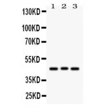 ATXN3 / JOS Antibody - Ataxin 3 antibody Western blot. All lanes: Anti Ataxin 3 at 0.5 ug/ml. Lane 1: Rat Brain Tissue Lysate at 50 ug. Lane 2: COLO320 Whole Cell Lysate at 40 ug. Lane 3: HELA Whole Cell Lysate at 40 ug. Predicted band size: 42 kD. Observed band size: 42 kD.
