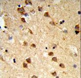 ATXN3 / JOS Antibody - Formalin-fixed and paraffin-embedded human brain tissue reacted with ATXN3 Antibody , which was peroxidase-conjugated to the secondary antibody, followed by DAB staining. This data demonstrates the use of this antibody for immunohistochemistry; clinical relevance has not been evaluated.