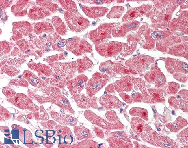 ATXN3 / JOS Antibody - Human Heart: Formalin-Fixed, Paraffin-Embedded (FFPE).  This image was taken for the unconjugated form of this product. Other forms have not been tested.