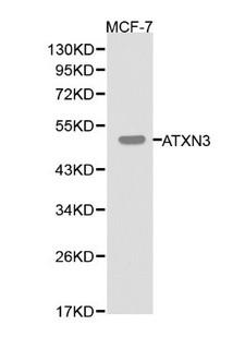 ATXN3 / JOS Antibody - Western blot of ATXN3 pAb in extracts from MCF-7 cells.