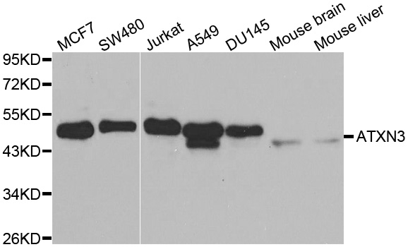 ATXN3 / JOS Antibody - Western blot analysis of extracts of various cell lines.