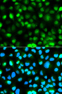 ATXN3 / JOS Antibody - Immunofluorescence analysis of HeLa cells.