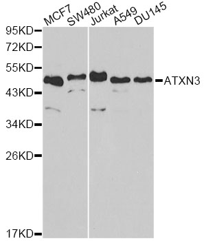 ATXN3 / JOS Antibody - Western blot analysis of extracts of various cell lines, using ATXN3 antibody at 1:1000 dilution. The secondary antibody used was an HRP Goat Anti-Rabbit IgG (H+L) at 1:10000 dilution. Lysates were loaded 25ug per lane and 3% nonfat dry milk in TBST was used for blocking.