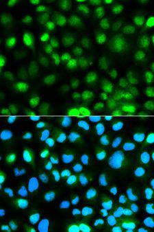 ATXN3 / JOS Antibody - Immunofluorescence analysis of HeLa cells using ATXN3 antibody. Blue: DAPI for nuclear staining.