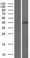 ATXN3L Protein - Western validation with an anti-DDK antibody * L: Control HEK293 lysate R: Over-expression lysate