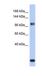 ATXN7 / SCA7 / Ataxin-7 Antibody - ATXN7 / Ataxin-7 antibody Western blot of ACHN lysate. This image was taken for the unconjugated form of this product. Other forms have not been tested.