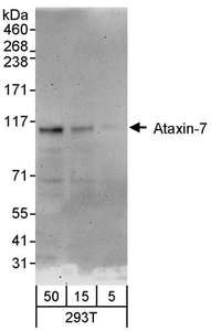 ATXN7 / SCA7 / Ataxin-7 Antibody - Detection of Human Ataxin-7 by Western Blot. Samples: Whole cell lysate (5, 15 and 50 ug) from 293T cells. Antibodies: Affinity purified rabbit anti-Ataxin-7 antibody used for WB at 0.4 ug/ml. Detection: Chemiluminescence with an exposure time of 30 seconds.