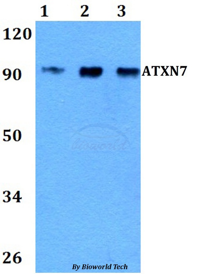 ATXN7 / SCA7 / Ataxin-7 Antibody - Western blot of ATXN7 antibody at 1:500 dilution. Lane 1: A549 whole cell lysate. Lane 2: NIH-3T3 whole cell lysate. Lane 3: PC12 whole cell lysate.