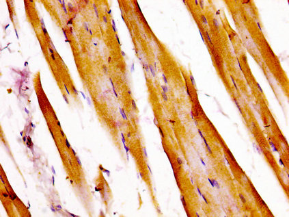 ATXN7 / SCA7 / Ataxin-7 Antibody - Immunohistochemistry image at a dilution of 1:400 and staining in paraffin-embedded human skeletal muscle tissue performed on a Leica BondTM system. After dewaxing and hydration, antigen retrieval was mediated by high pressure in a citrate buffer (pH 6.0) . Section was blocked with 10% normal goat serum 30min at RT. Then primary antibody (1% BSA) was incubated at 4 °C overnight. The primary is detected by a biotinylated secondary antibody and visualized using an HRP conjugated SP system.