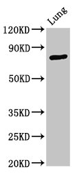 ATXN7 / SCA7 / Ataxin-7 Antibody - Positive Western Blot detected in Rat lung tissue. All lanes: ATXN7 antibody at 3.3 µg/ml Secondary Goat polyclonal to rabbit IgG at 1/50000 dilution. Predicted band size: 96, 102, 80 KDa. Observed band size: 80 KDa