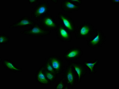 ATXN7 / SCA7 / Ataxin-7 Antibody - Immunofluorescence staining of A549 cells with ATXN7 Antibody at 1:133, counter-stained with DAPI. The cells were fixed in 4% formaldehyde, permeabilized using 0.2% Triton X-100 and blocked in 10% normal Goat Serum. The cells were then incubated with the antibody overnight at 4°C. The secondary antibody was Alexa Fluor 488-congugated AffiniPure Goat Anti-Rabbit IgG(H+L).