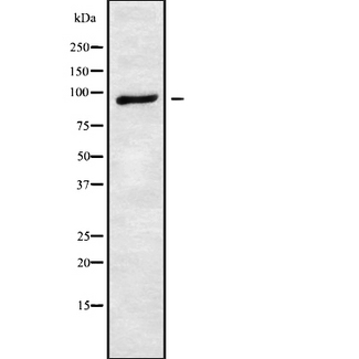 ATXN7 / SCA7 / Ataxin-7 Antibody - Western blot analysis of ATXN7 using HuvEc whole cells lysates