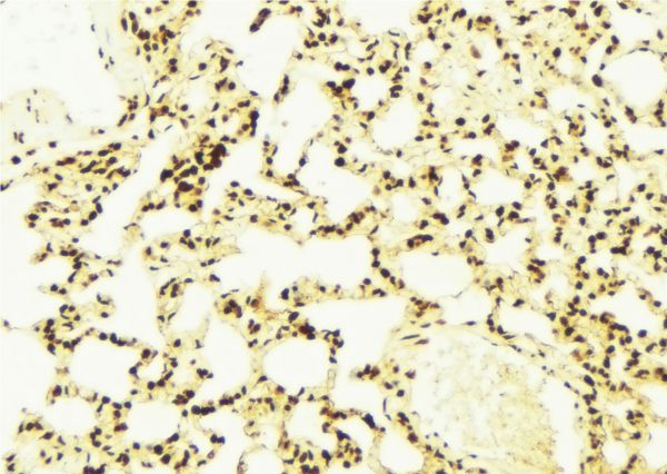 ATXN7 / SCA7 / Ataxin-7 Antibody - 1:100 staining mouse lung tissue by IHC-P. The sample was formaldehyde fixed and a heat mediated antigen retrieval step in citrate buffer was performed. The sample was then blocked and incubated with the antibody for 1.5 hours at 22°C. An HRP conjugated goat anti-rabbit antibody was used as the secondary.