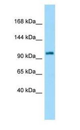 ATXN7 / SCA7 / Ataxin-7 Antibody - ATXN7 / SCA7 / Ataxin-7 antibody Western Blot of Rat Small Intestine. Antibody dilution: 1 ug/ml.  This image was taken for the unconjugated form of this product. Other forms have not been tested.