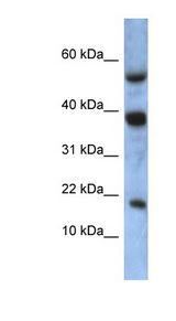 ATXN7L1 Antibody - ATXN7L1 antibody Western blot of MCF7 cell lysate. This image was taken for the unconjugated form of this product. Other forms have not been tested.