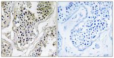 ATXN7L1 Antibody - Immunohistochemistry analysis of paraffin-embedded human testis tissue, using ATXN7L1 Antibody. The picture on the right is blocked with the synthesized peptide.