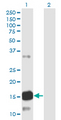 ATXN7L1 Antibody - Western blot of ATXN7L1 expression in transfected 293T cell line by ATXN7L1 monoclonal antibody (M06), clone 1H2.