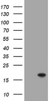 ATXN7L1 Antibody - HEK293T cells were transfected with the pCMV6-ENTRY control (Left lane) or pCMV6-ENTRY ATXN7L1 (Right lane) cDNA for 48 hrs and lysed. Equivalent amounts of cell lysates (5 ug per lane) were separated by SDS-PAGE and immunoblotted with anti-ATXN7L1.