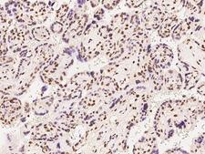 ATXN7L1 Antibody - Immunochemical staining of human ATXN7L1 in human placenta with rabbit polyclonal antibody at 1:100 dilution, formalin-fixed paraffin embedded sections.