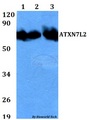 ATXN7L2 Antibody - Western blot of ATXN7L2 antibody at 1:500 dilution. Lane 1: HEK293T whole cell lysate. Lane 2: Raw264.7 whole cell lysate. Lane 3: H9C2 whole cell lysate.