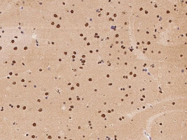ATXN7L2 Antibody - Immunochemical staining of human ATXN7L2 in human brain with rabbit polyclonal antibody at 1:500 dilution, formalin-fixed paraffin embedded sections.
