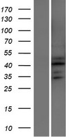 ATXN7L2 Protein - Western validation with an anti-DDK antibody * L: Control HEK293 lysate R: Over-expression lysate