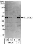 ATXN7L3 Antibody - Detection of Human ATXN7L3 by Western Blot. Samples: Whole cell lysate from HeLa (5, 15 and 50 ug) and 293T (T; 50 ug) cells. Antibody: Affinity purified rabbit anti-ATXN7L3 antibody used at 0.4 ug/ml. Detection: Chemiluminescence with an exposure time of 3 minutes.