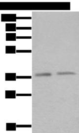 ATXN7L3 Antibody - Western blot analysis of Hela and Raji cell lysates  using ATXN7L3 Polyclonal Antibody at dilution of 1:500