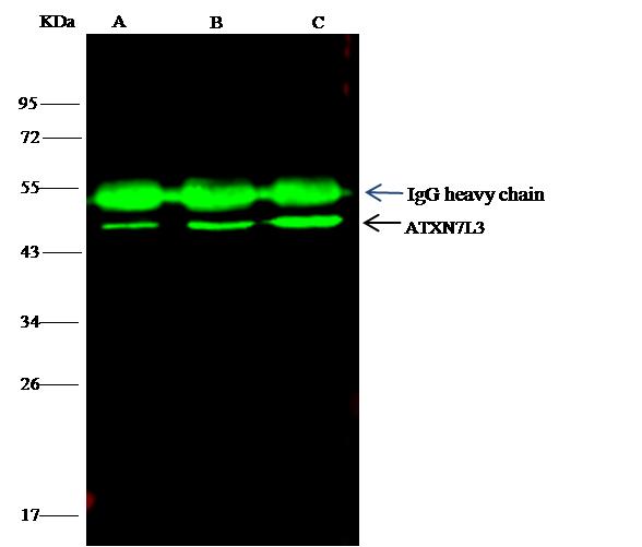 ATXN7L3 Antibody - ATXN7L3 was immunoprecipitated using: Lane A:0.5 mg Raji Whole Cell Lysate. Lane B:0.5 mg K562 Whole Cell Lysate. Lane C:0.5 mg THP-1 Whole Cell Lysate. 4 uL anti-ATXN7L3 rabbit polyclonal antibody and 15 ul of 50 % Protein G agarose. Primary antibody:Anti-ATXN7L3 rabbit polyclonal antibody,at 1:100 dilution. Secondary antibody: Dylight 800-labeled antibody to rabbit IgG (H+L), at 1:5000 dilution. Developed using the odssey technique. Performed under reducing conditions. Predicted band size: 38 kDa. Observed band size: 45 kDa.