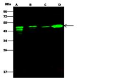 ATXN7L3 Antibody - Anti-ATXN7L3 rabbit polyclonal antibody at 1:500 dilution. Lane A: Jurkat Whole Cell Lysate. Lane B: Raji Whole Cell Lysate. Lane C: K562 Whole Cell Lysate. Lane D: THP1 Whole Cell Lysate. Lysates/proteins at 30 ug per lane. Secondary: Goat Anti- Rabbit  IgG H&L (Dylight 800)  at 1/10000 dilution. Developed using the Odyssey technique. Performed under reducing conditions. Predicted band size: 39 kDa. Observed band size: 49 kDa. (We are unsure as to the identity of these extra bands.)