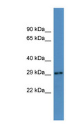AUH Antibody - AUH antibody Western blot of Mouse Heart lysate. This image was taken for the unconjugated form of this product. Other forms have not been tested.