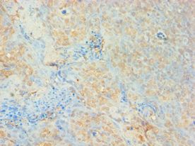 AUH Antibody - Immunohistochemistry of paraffin-embedded human tonsil using antibody at 1:100 dilution.