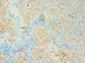 AUH Antibody - Immunohistochemistry of paraffin-embedded human tonsil tissue using AUH Antibody at dilution of 1: 100