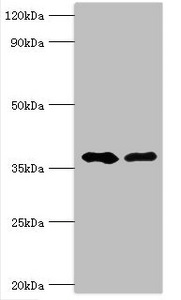 AUH Antibody - Western blot All lanes: Methylglutaconyl-CoA hydratase, mitochondrial antibody at 6µg/ml Lane 1: Rat brain tissue Lane 2: Rat kidney tissue Secondary Goat polyclonal to rabbit IgG at 1/10000 dilution Predicted band size: 36, 33 kDa Observed band size: 36 kDa
