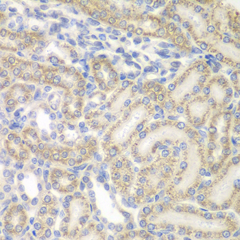 AUH Antibody - Immunohistochemistry of paraffin-embedded rat kidney tissue.